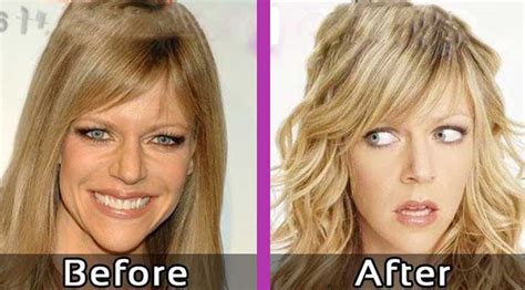 kaitlin olsen plastic surgery|Kaitlin Olson Plastic Surgery: ‘Sunny’ Star Responds to Speculation